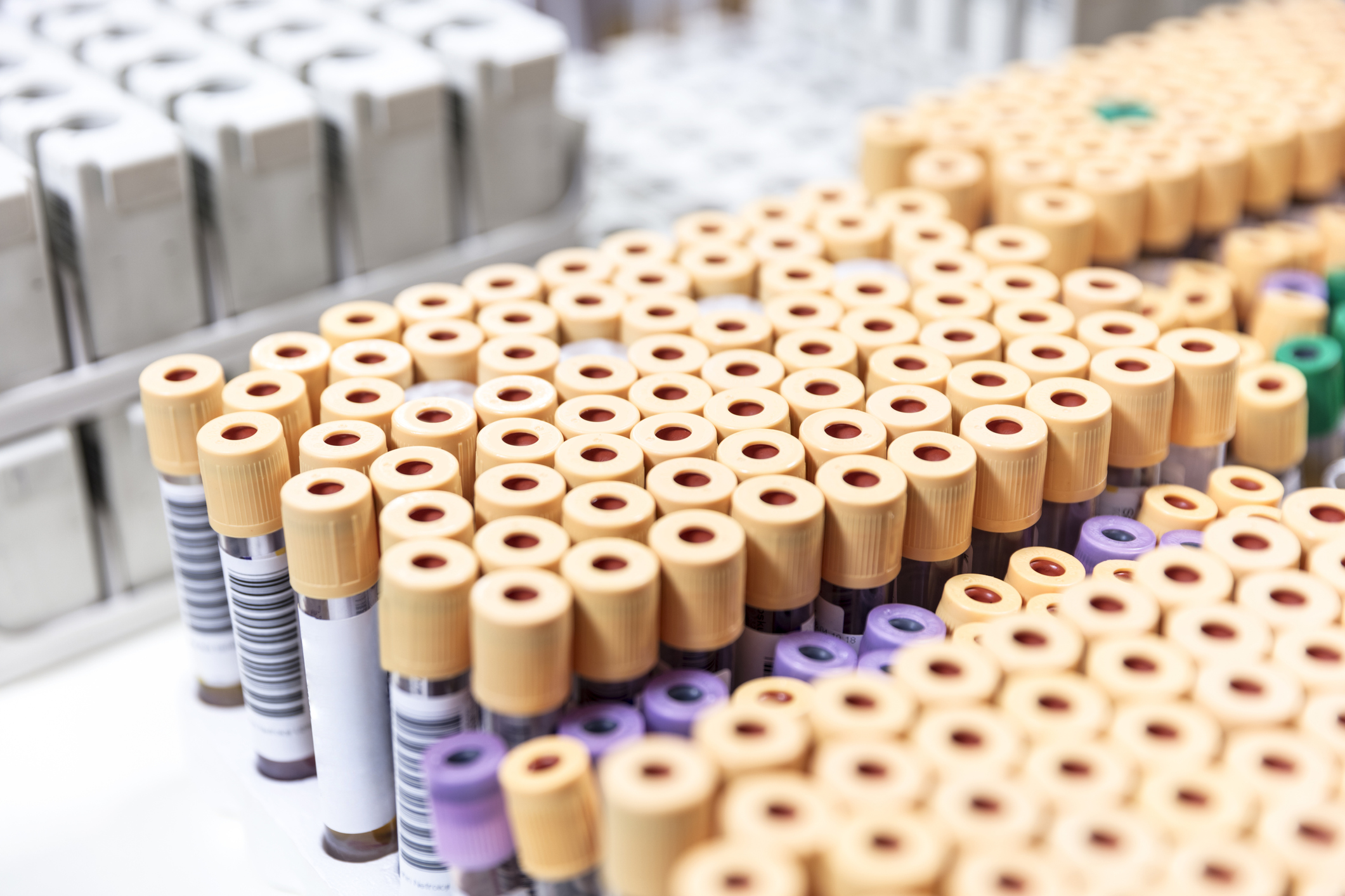 Test tubes in a tray