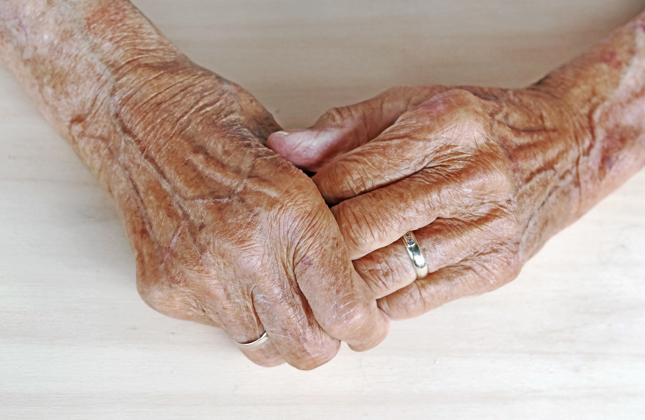 Two elderly hands clasped and resting on a table