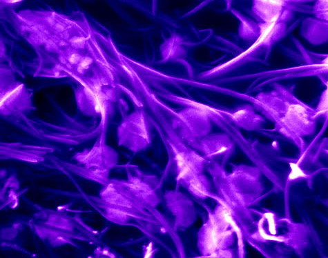 Scanning electron image in purple