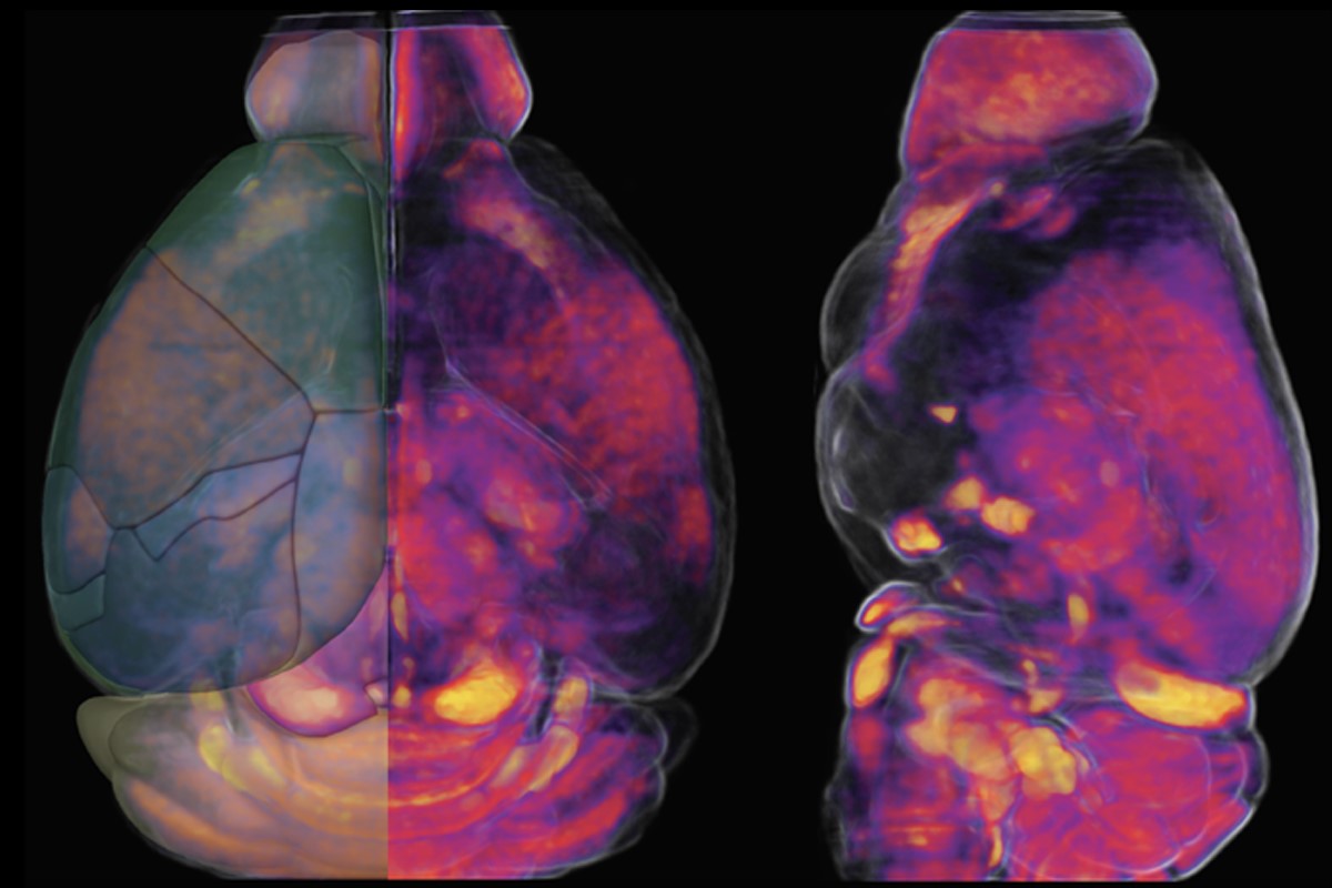 A scan of an adult mouse brain is shown from two different points of view. 