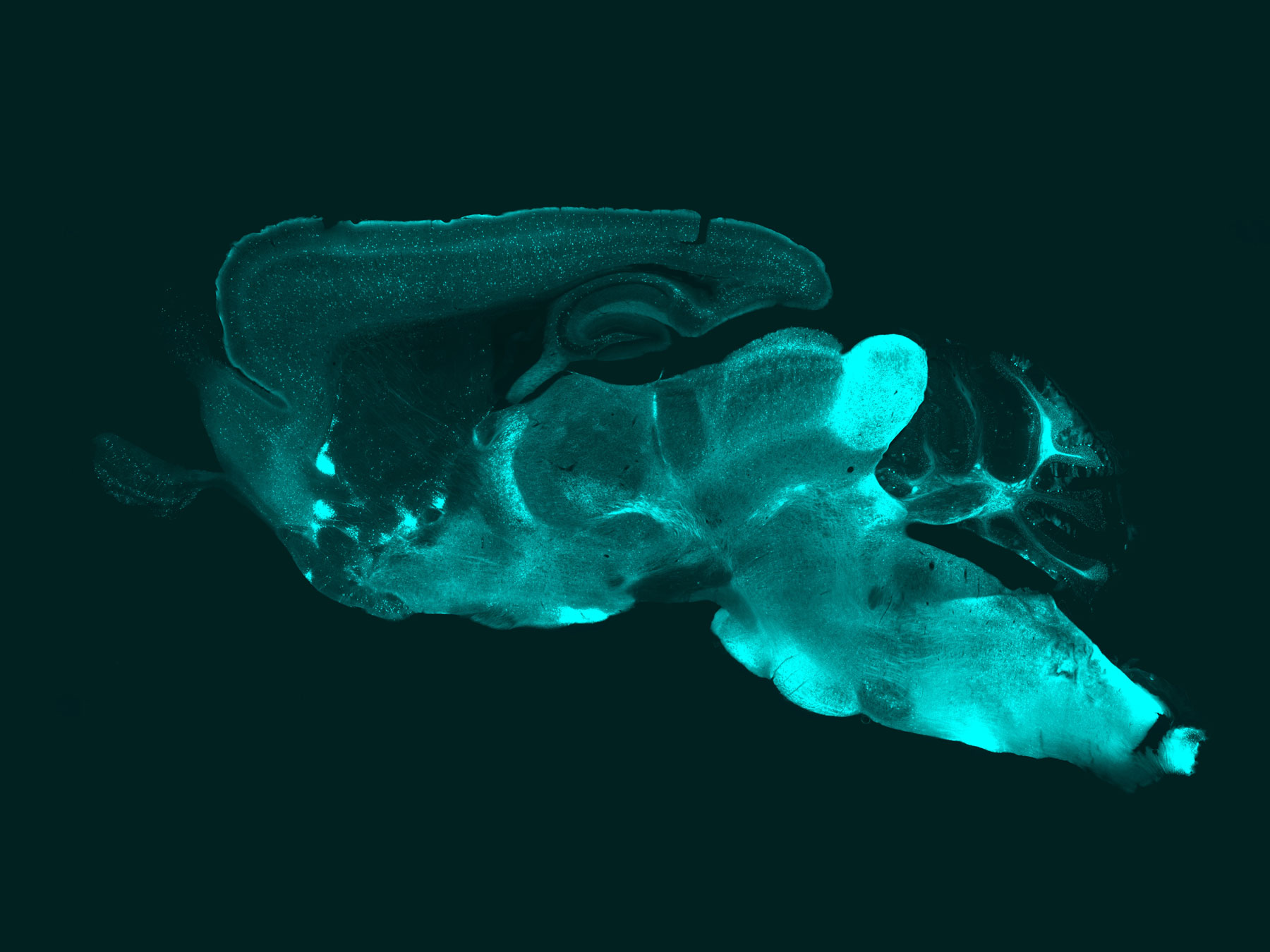 grayscale scan of mouse brain