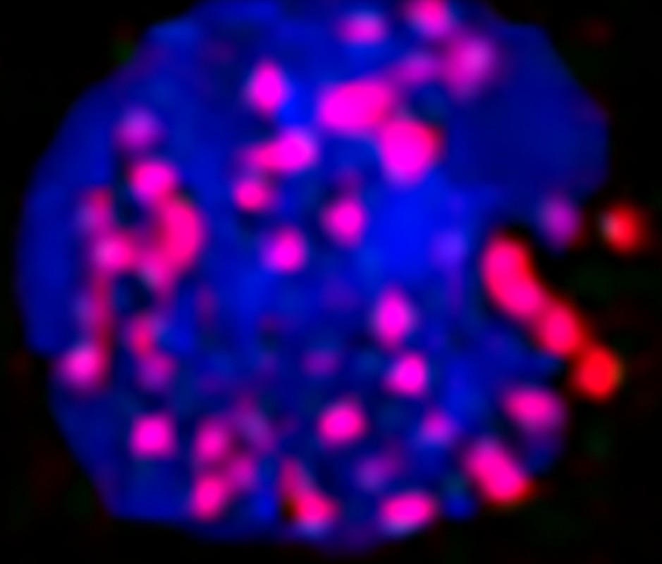 Replication protein A (RPA) forms a complex with WASp at replication forks within the nucleus of a human cell during DNA replication stress.  