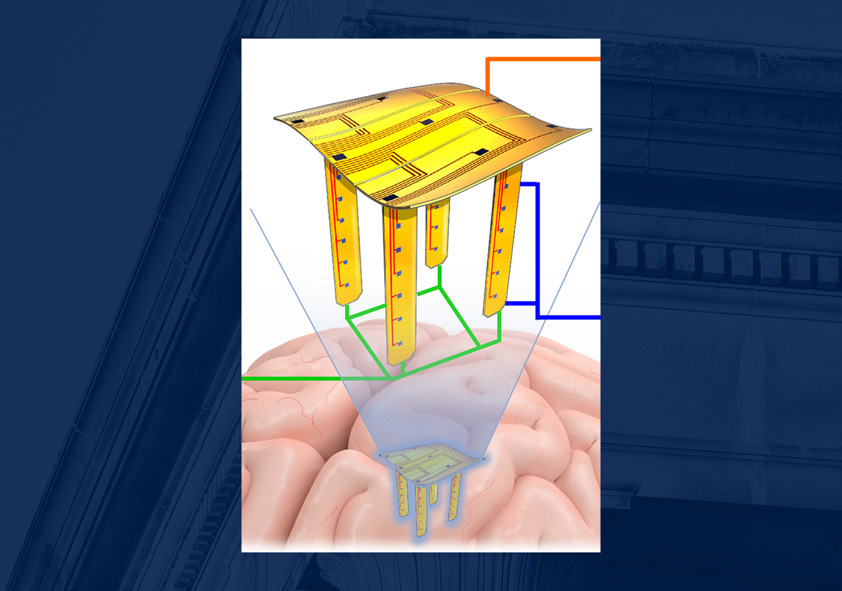 A rendering of a yellow square with four legs, like a table, being inserted into a depiction of a brain, all on a blue background.