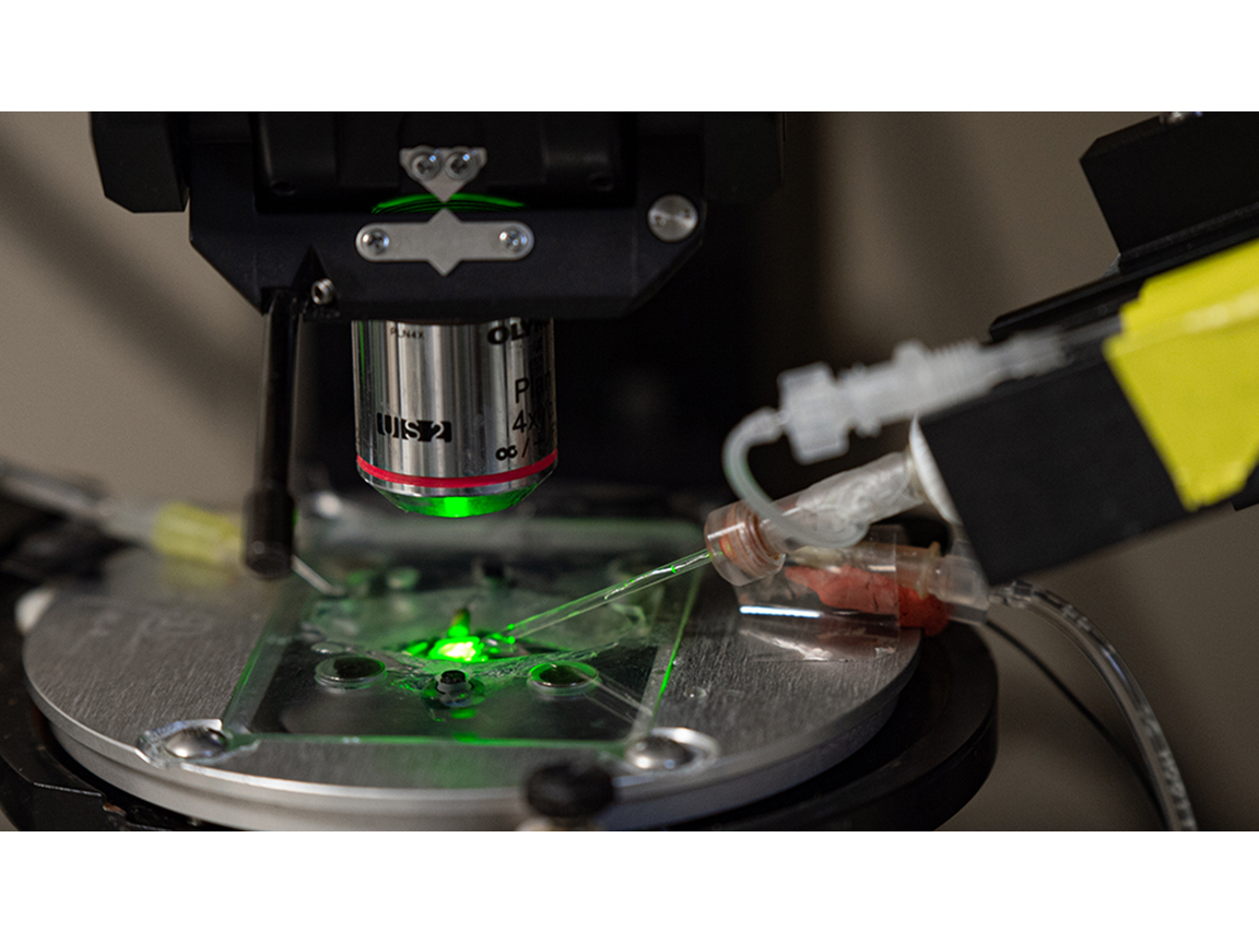 Microscope set up for patch-clamp electrophysiology for measuring somatostatin role in neural circuits