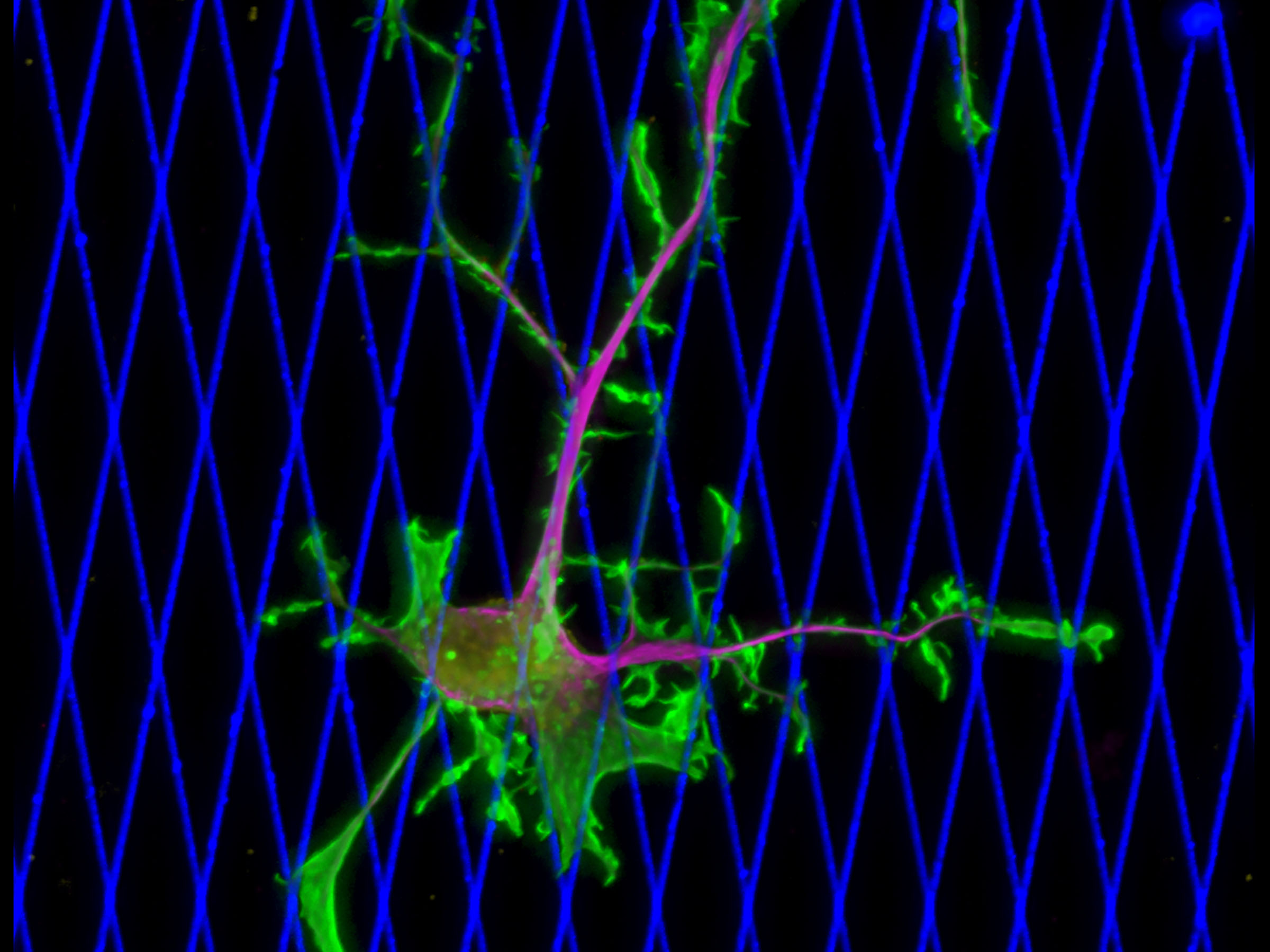 A fluorescent cell pictured on a neon grid  