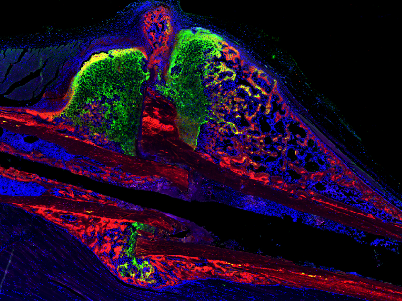 Microscope image of bone fracture with green, red, blue and purple light on a black background