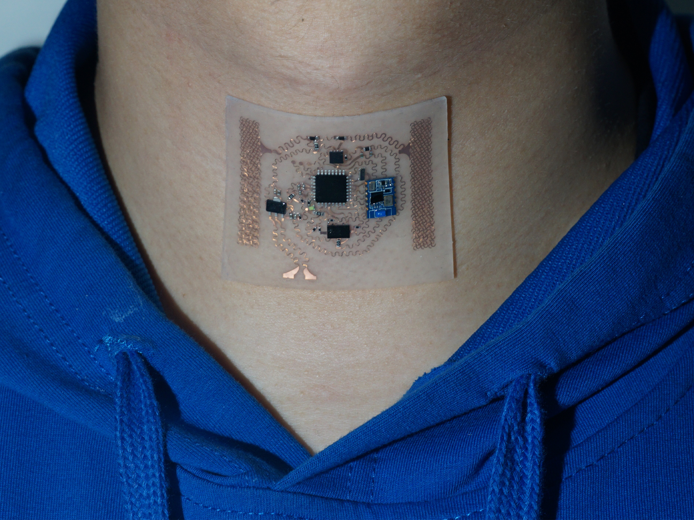 A wearable medical sensor is seen on an individual's neck.