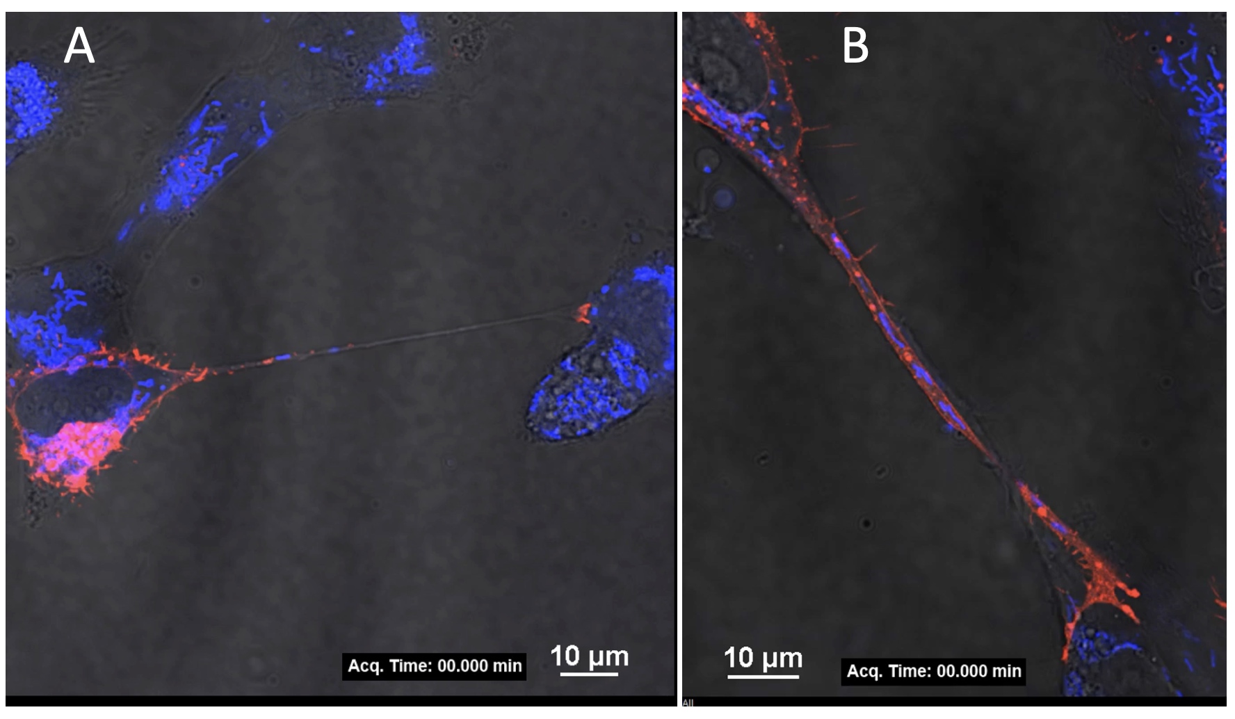 Human cells connected by tunneling nanotubes