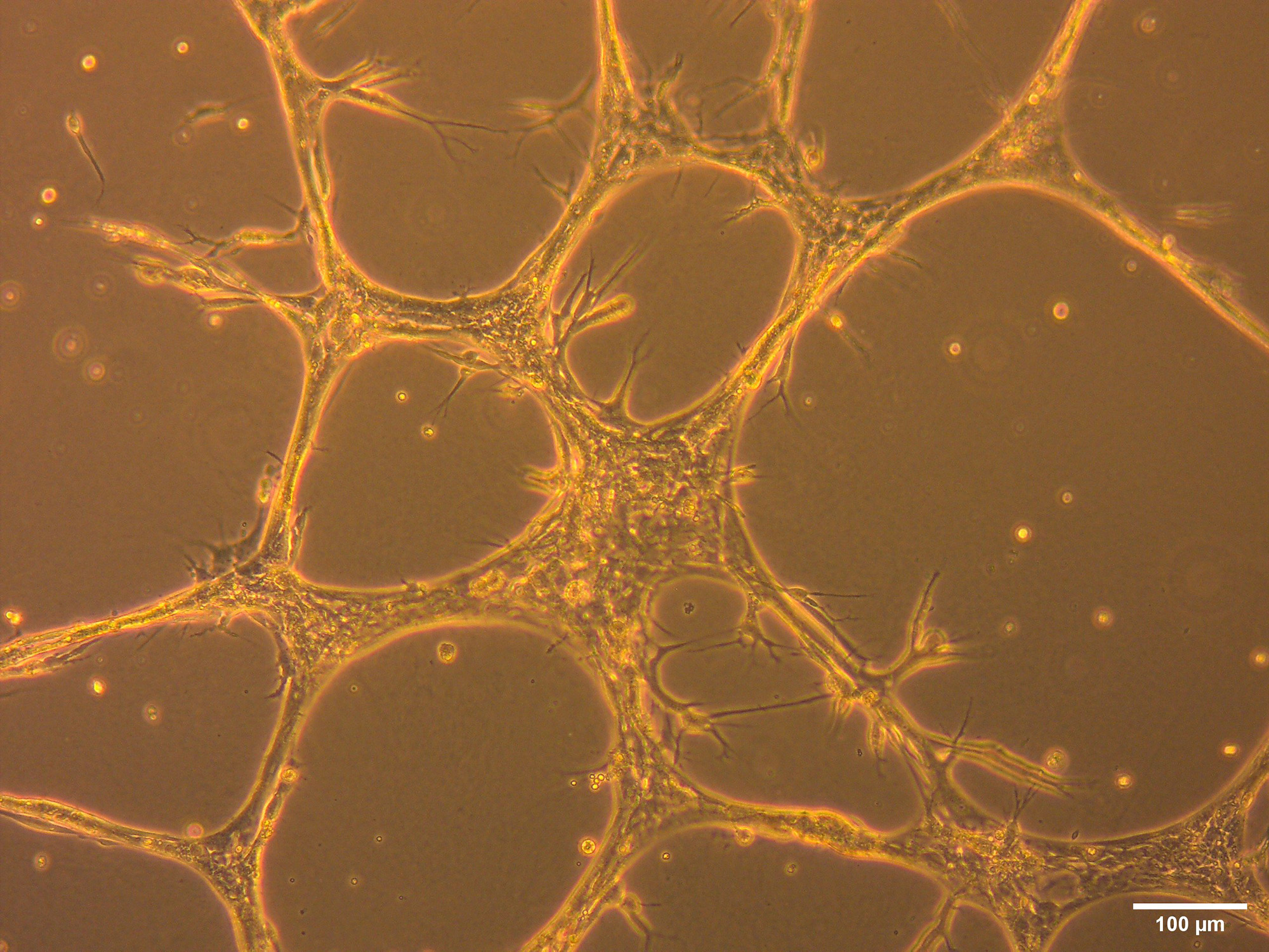 Orange tube-like structures spread across a brown background. 