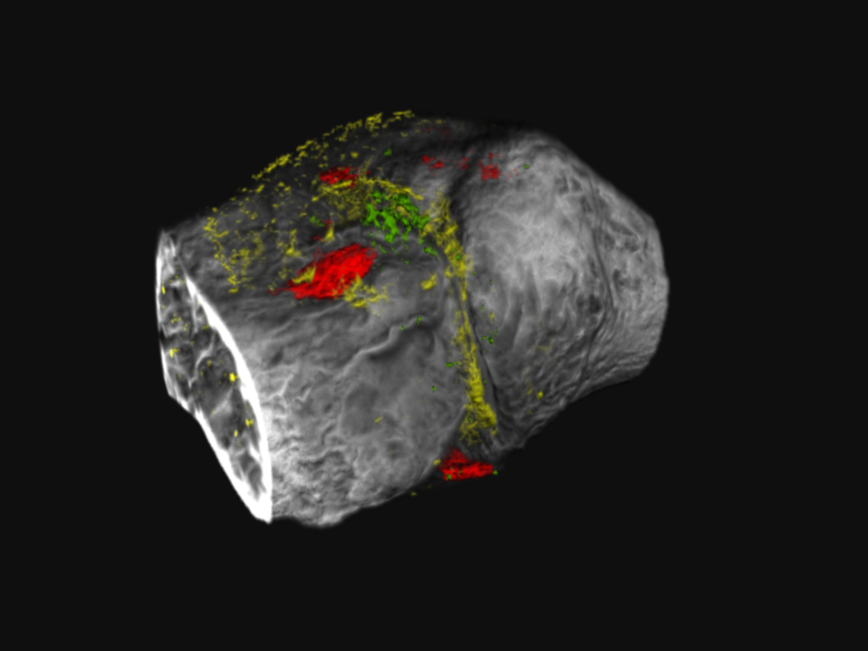 Image of gray bone with red, yellow and green visible