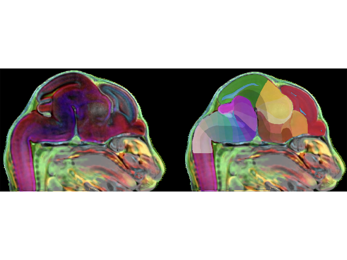 3D image of developing mouse brain