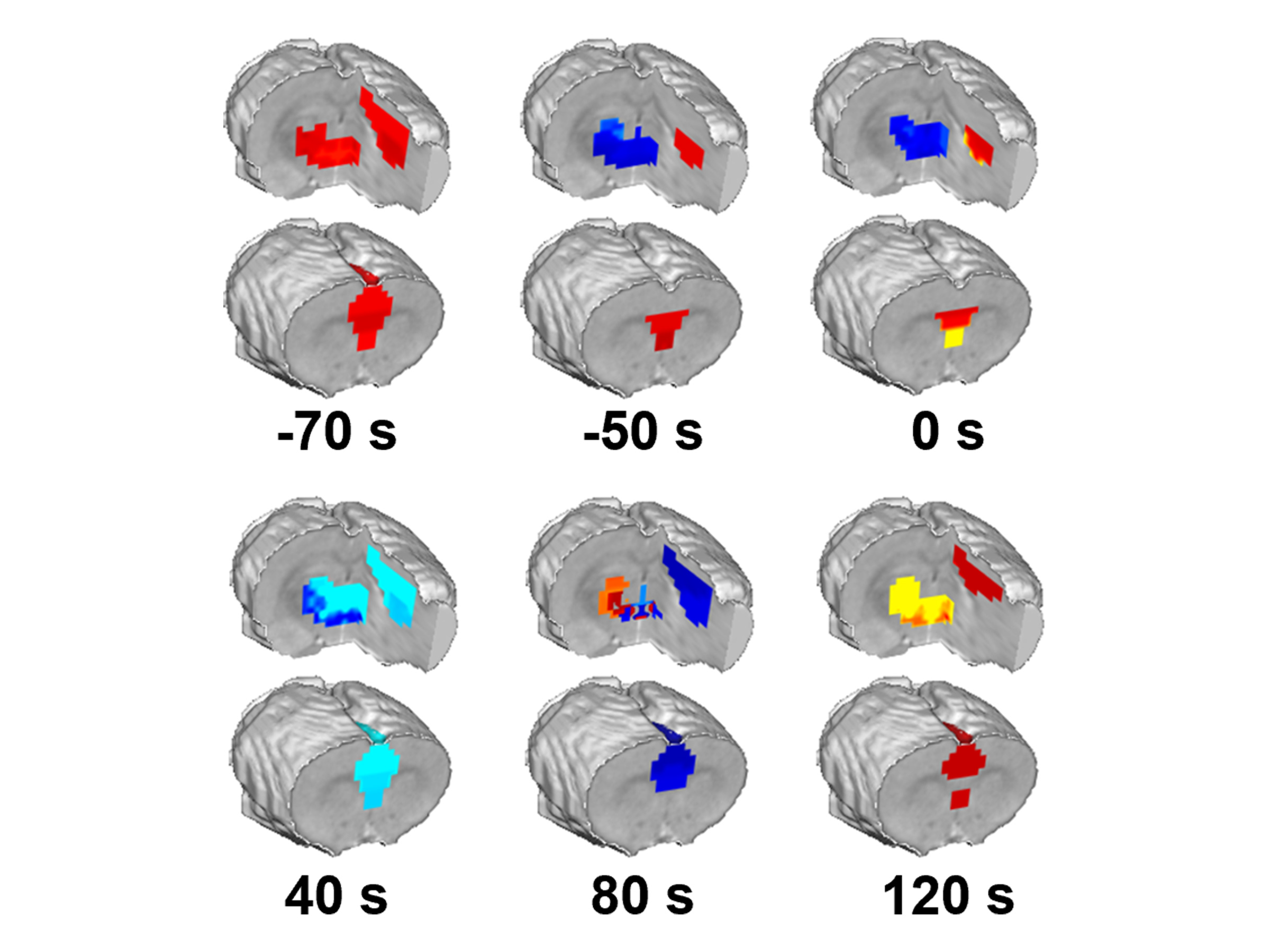 Twelve depictions of a brain.