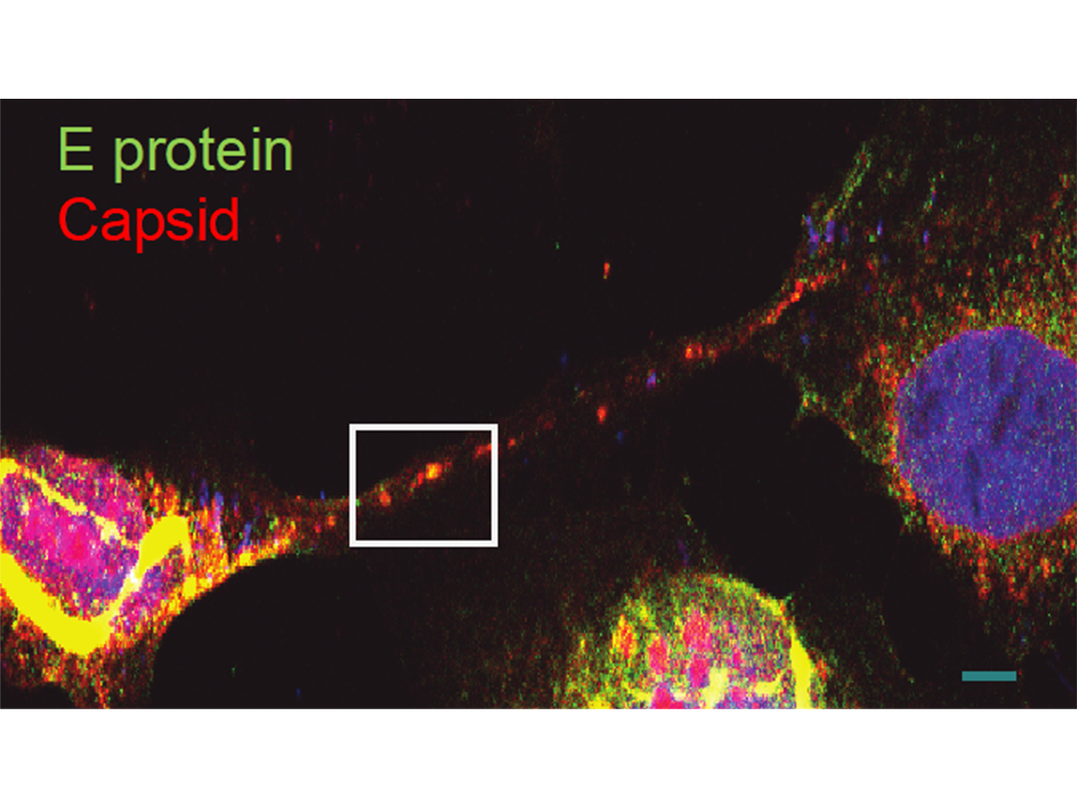 Tunnel-building virus: How Zika transmits from mother to fetus | Penn ...