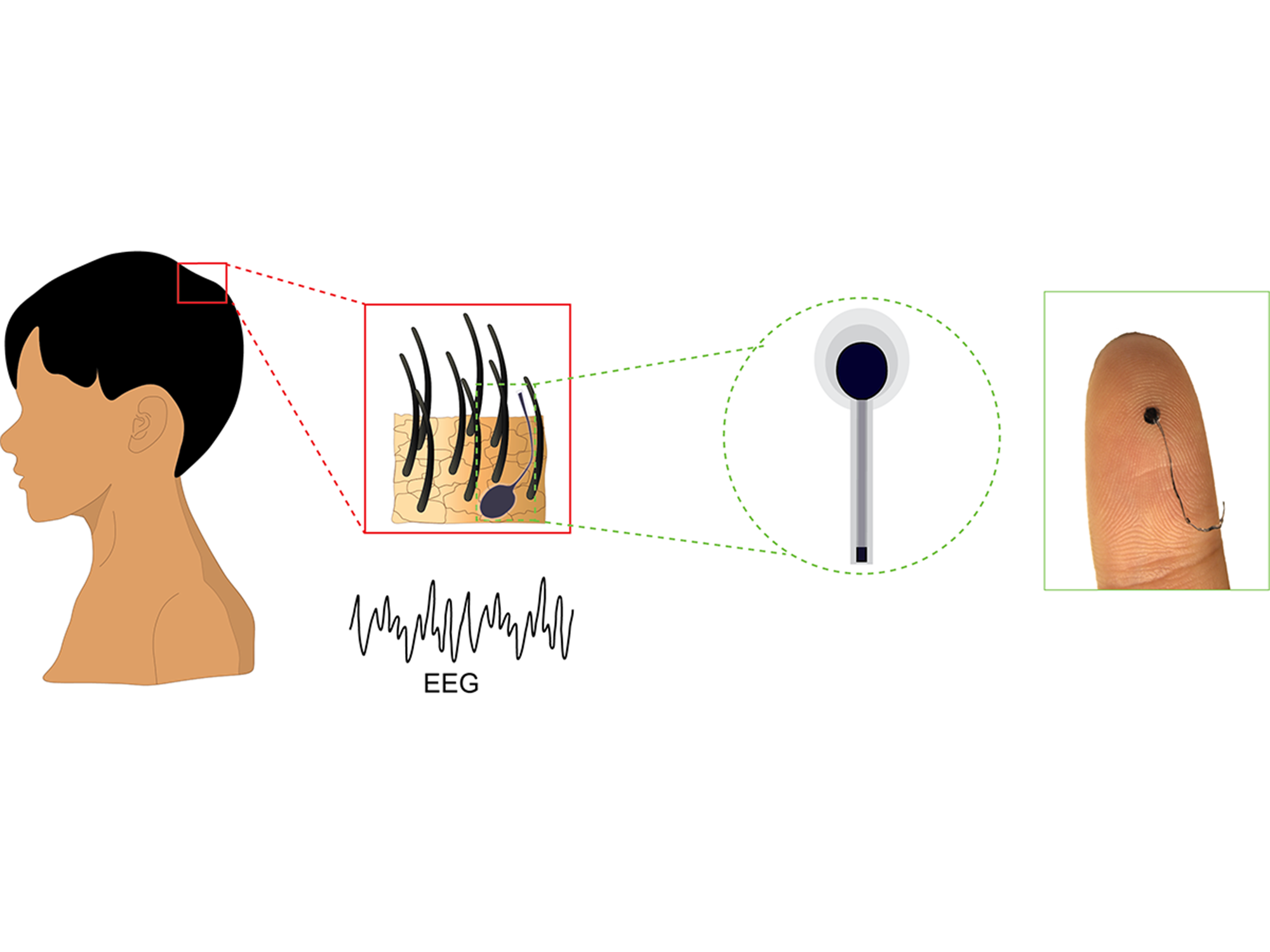 髪の毛のような脳活動モニタリング技術の将来(The future of brain activity monitoring may look like a strand of hair)