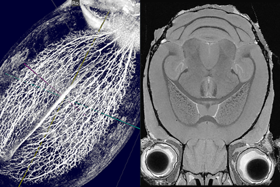 Huck launches new seed grant program to support research in MRI