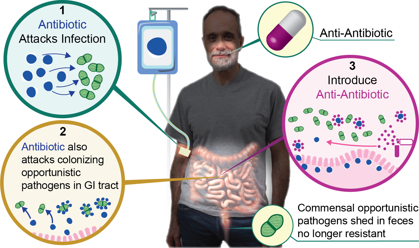 Diagram showing how anti-antibiotic works