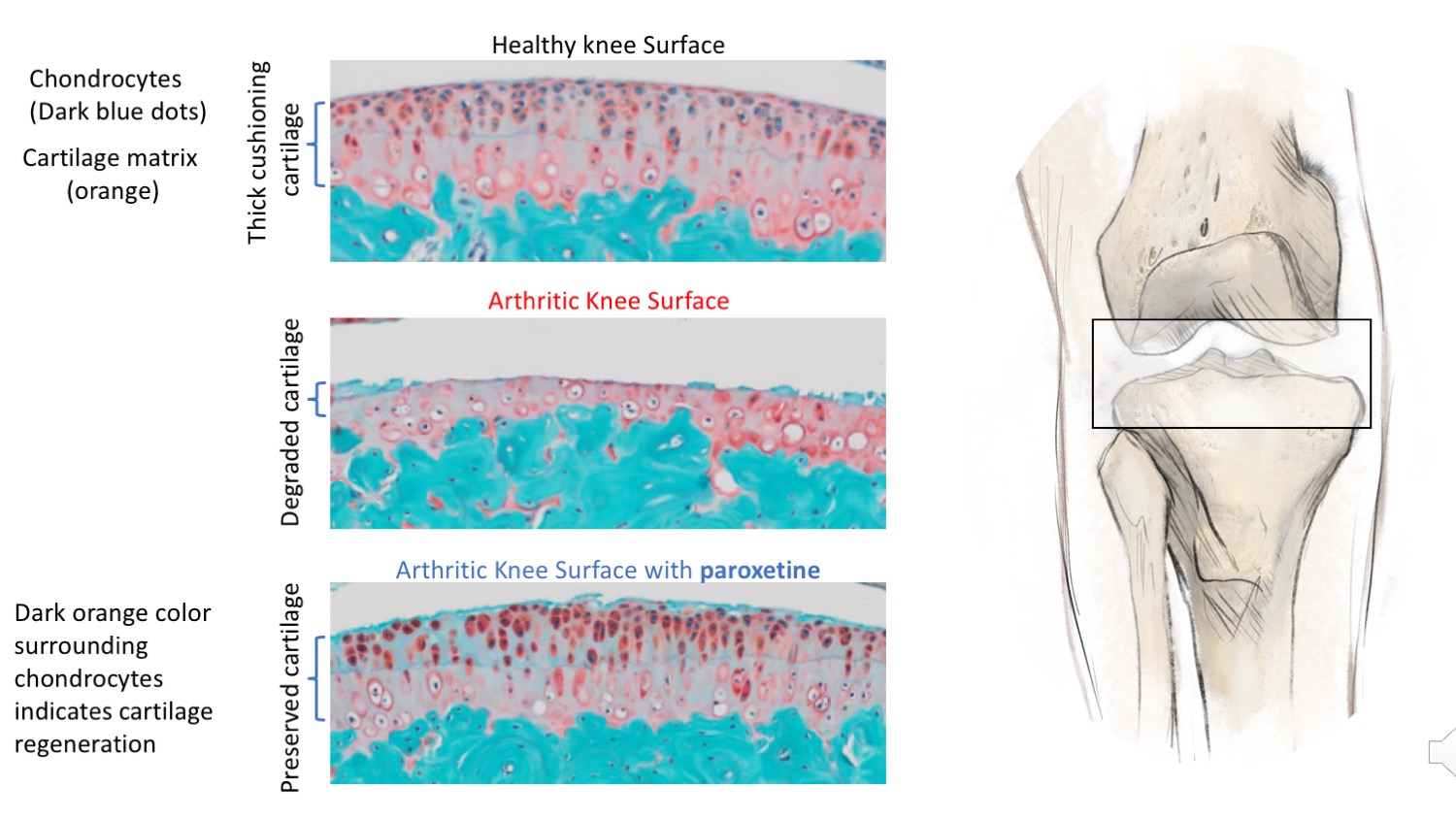 image showing cartilage regeneration