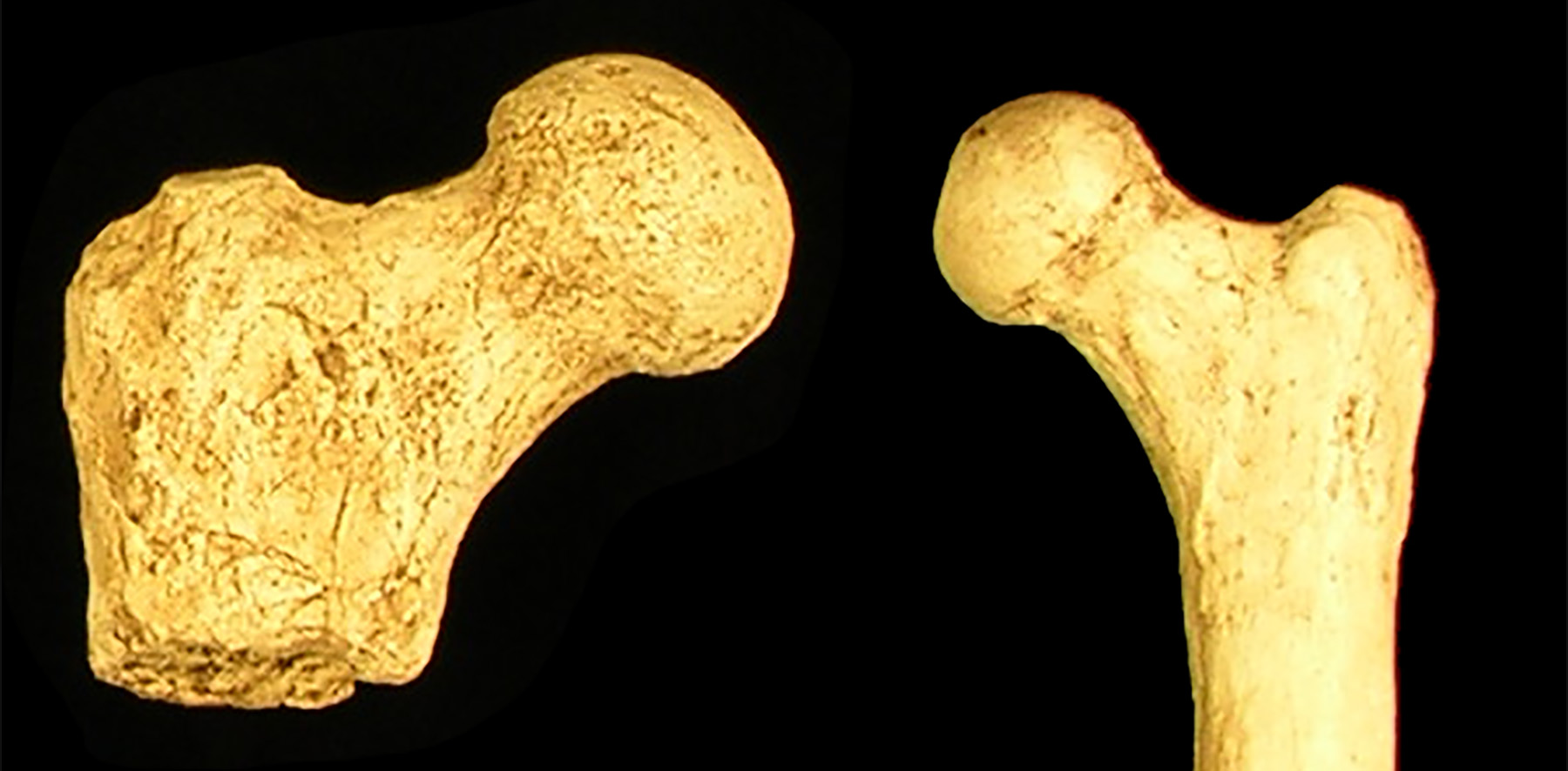 two femora bones