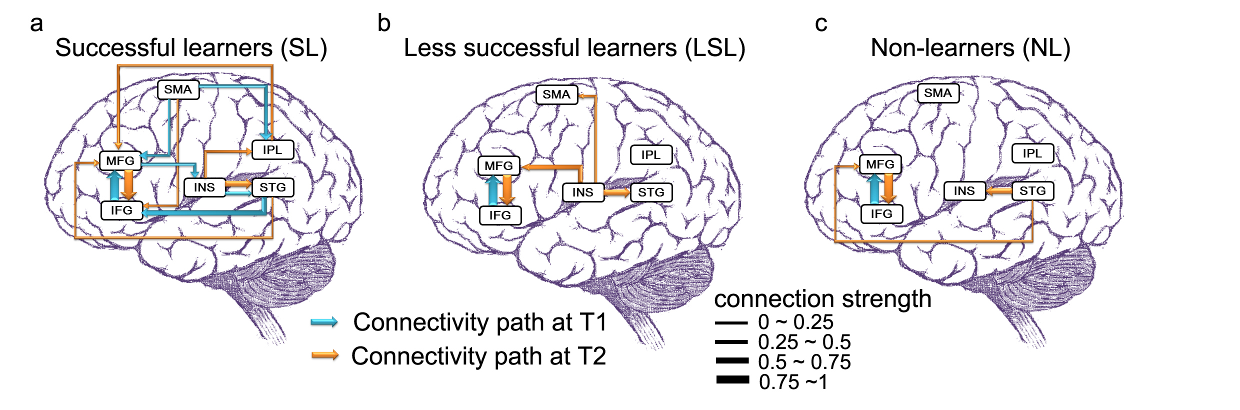 brain schematic