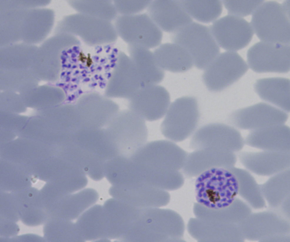 Malaria parasites in red blood cells