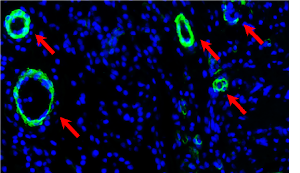 Image showing where blood vessels are growing.