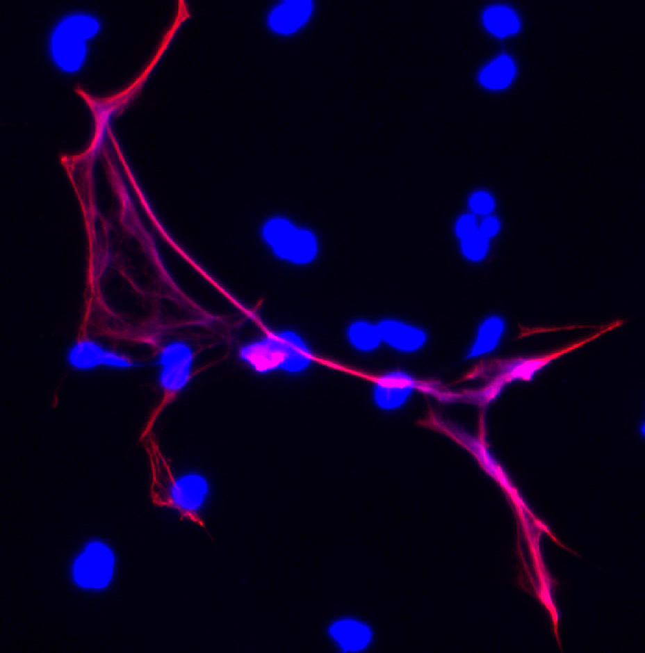 Chromatin and the PAD4 enzyme