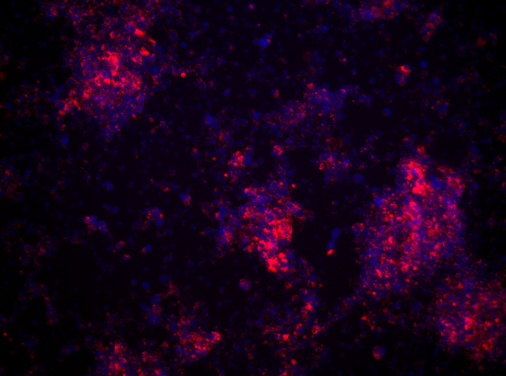 Wolbachia bacteria