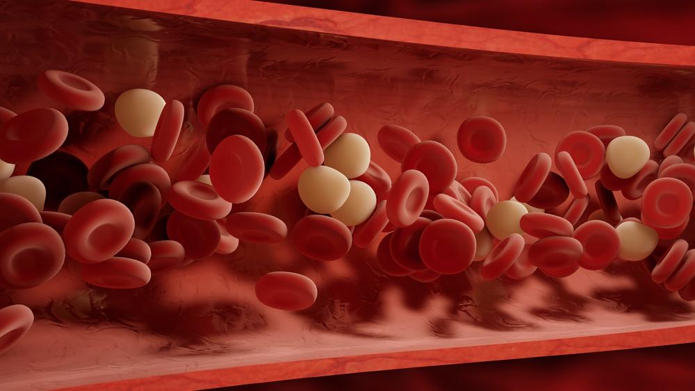 The Medical Minute Many treatments can mitigate blood clot dangers