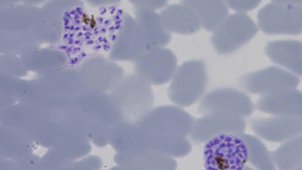 Malaria parasites sense and adapt to their host’s nutritional status