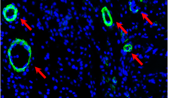 NIH grant recipients to develop novel coronary heart disease treatment ...