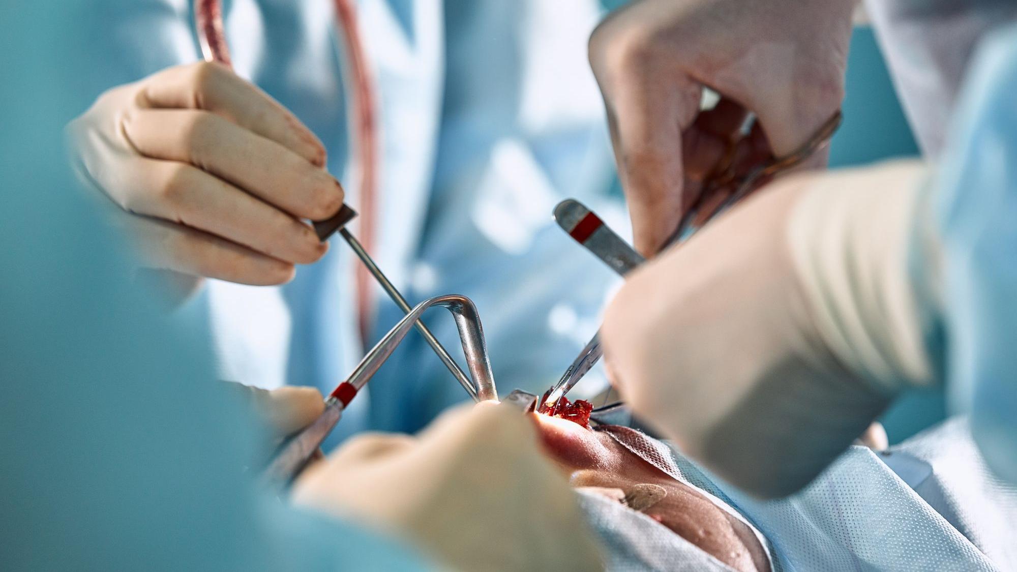Close up of a facial surgery