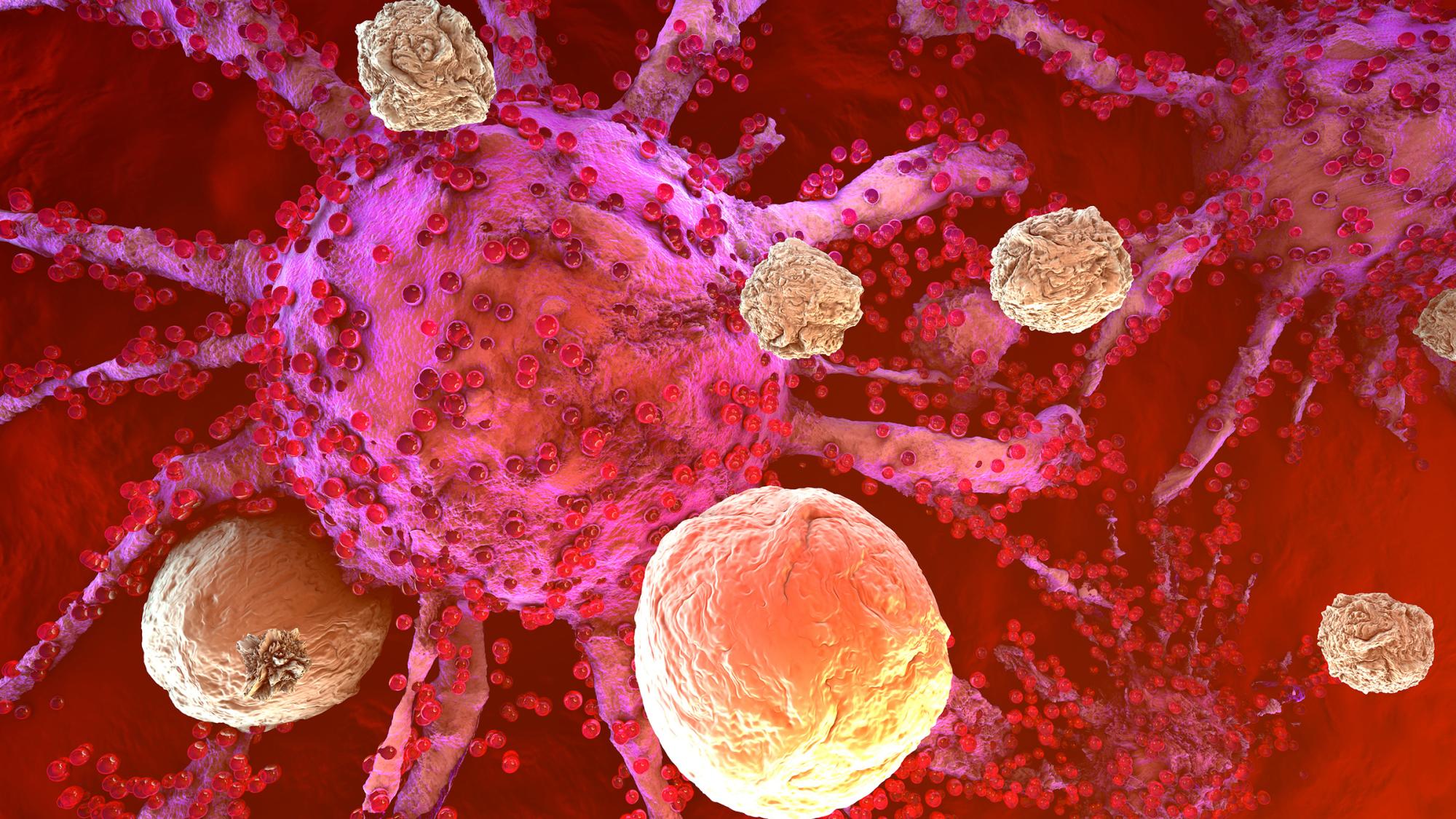 3D model of cancer cells being attacked by the immune system cells found in the body