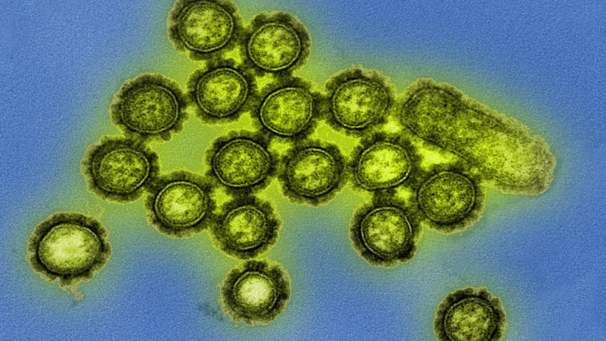 H1N1 influenza virus particles
