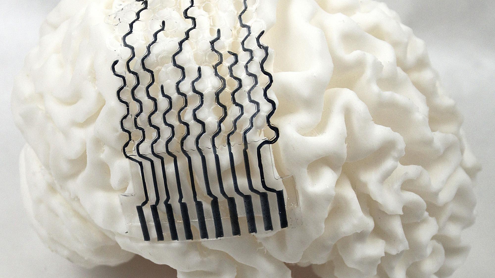 A picture of the team's bioelectrode design sitting on a 3D printed model of a patient's brain