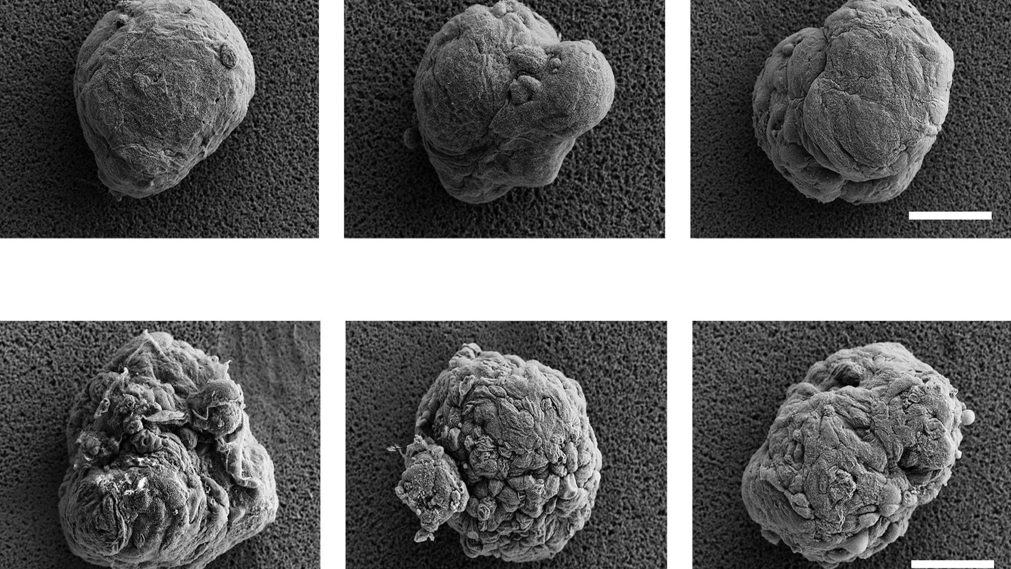 A researcher figure showing six microscopic images of cell clusters, or islets. The top three images show islets with a relatively smooth texture, while the bottom three images show cells with a rough texture as a result of the team's new research development