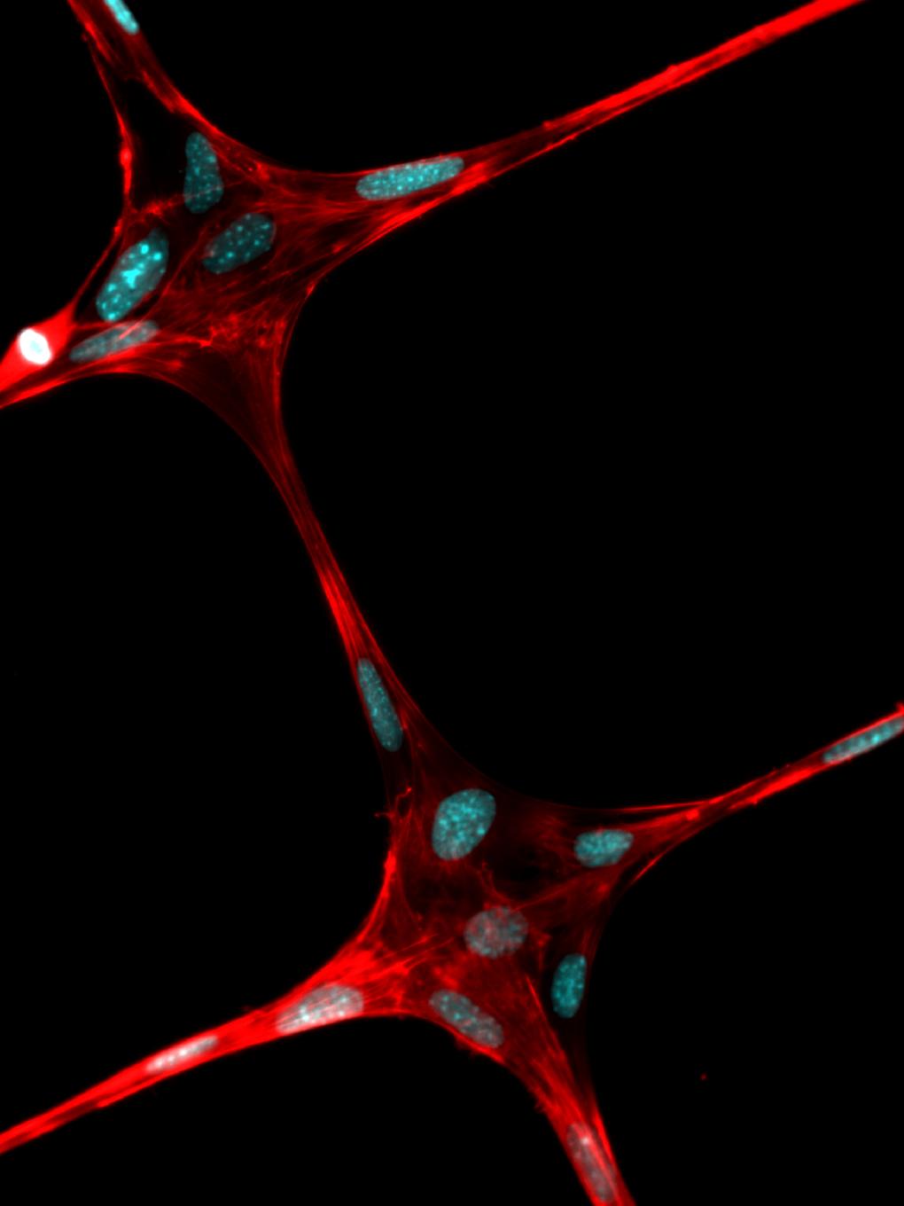 cells grown on polymeric fibers
