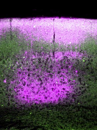 Image of the brain showing pink area of nitric oxide and green areas of another neuron