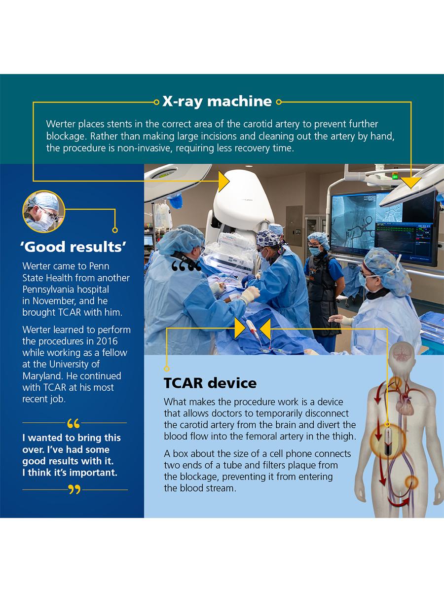 TCAR device graphic