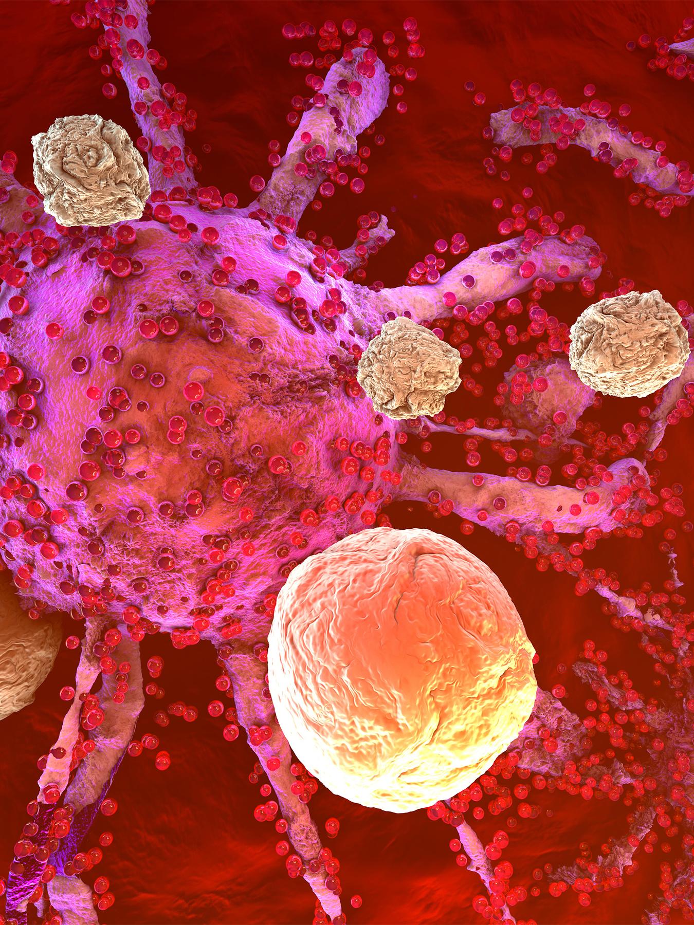 3D model of cancer cells being attacked by the immune system cells found in the body