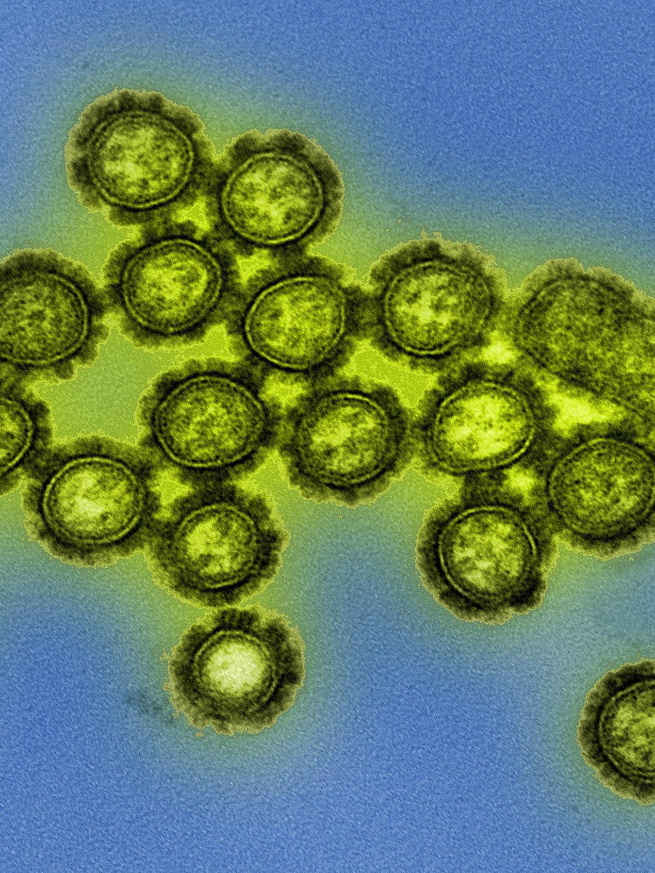 H1N1 influenza virus particles