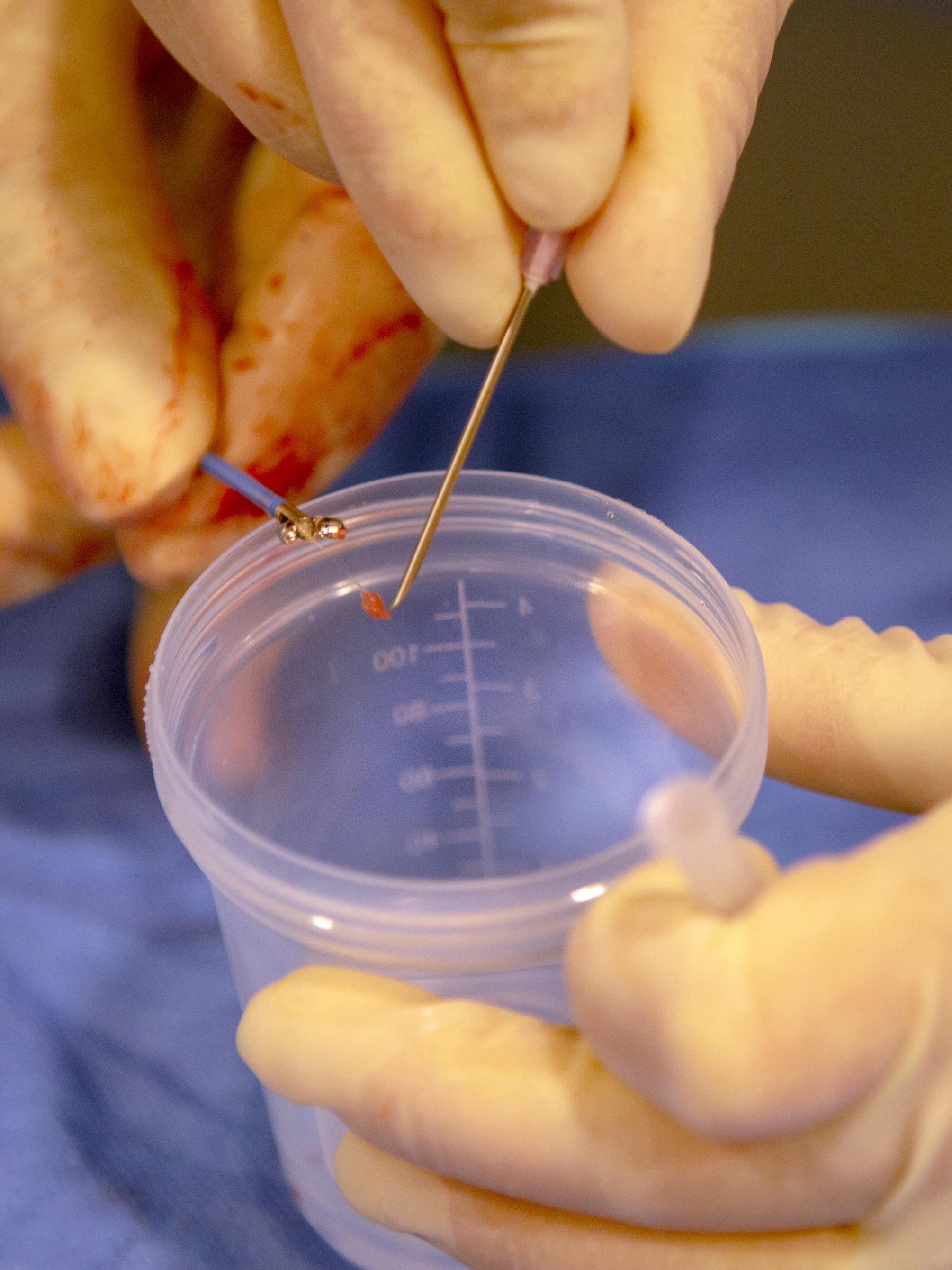 500th heart transplant - Penn State Health Milton S. Hershey Medical Center