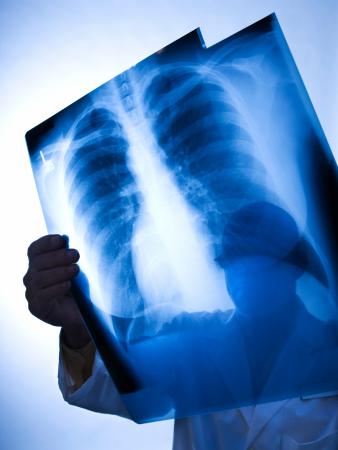 Healthcare worker holding up X-ray
