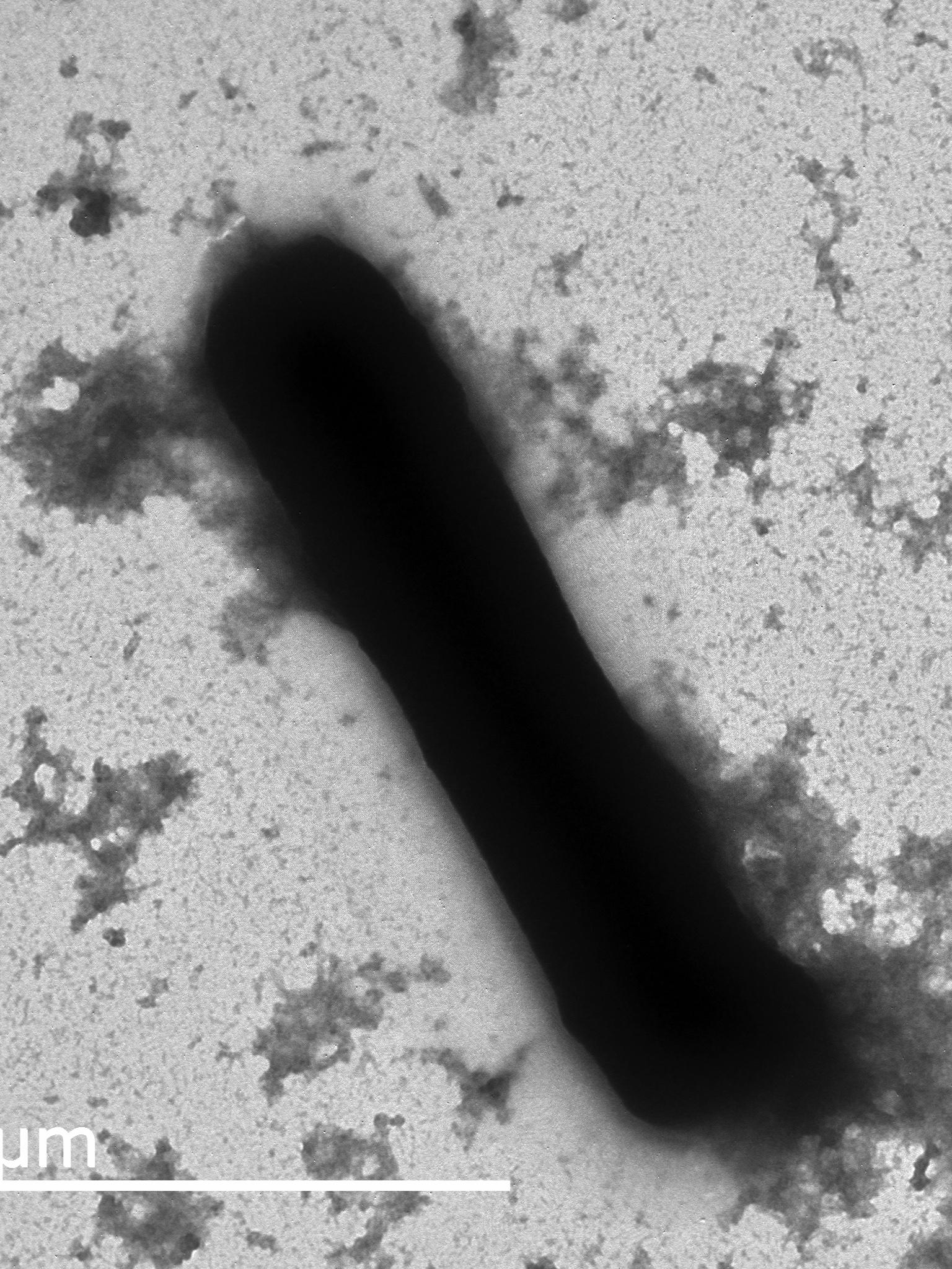 electron microscope image