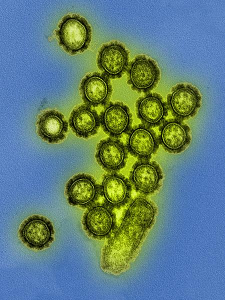 Colorized micrograph influenza strain H1N1 particles