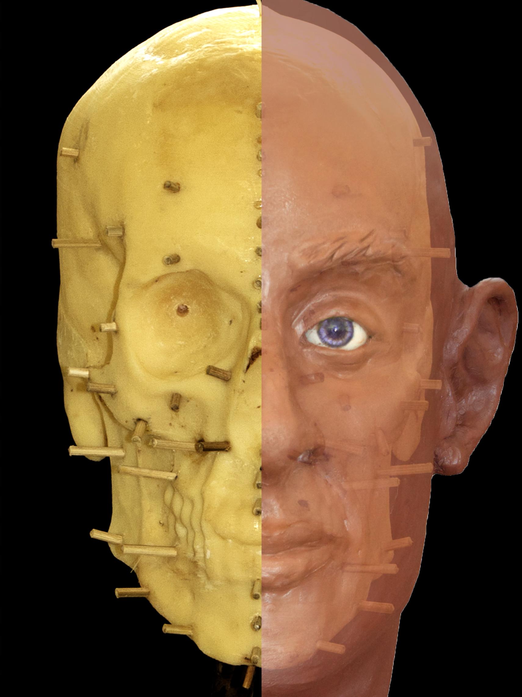 model of 3D head half face half skull with reconstruction marker pegs