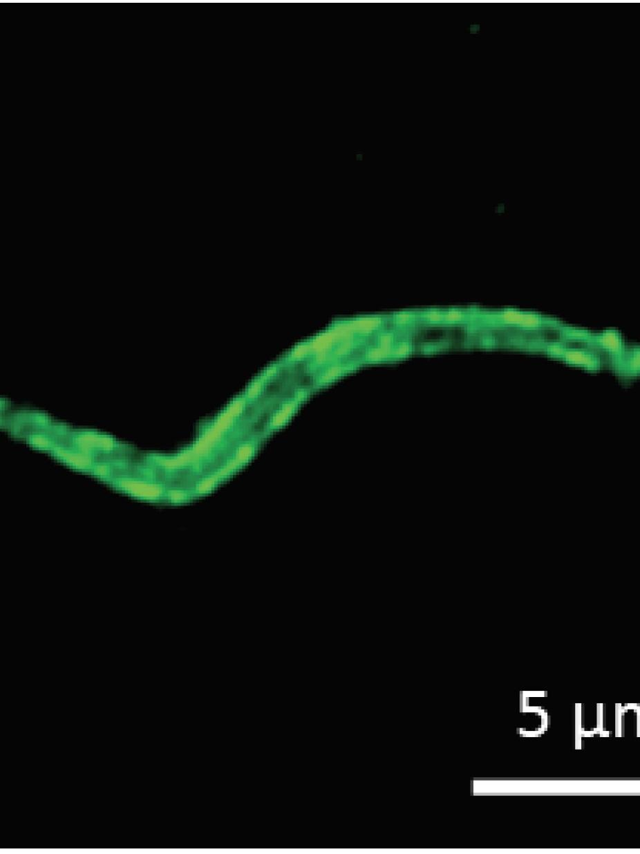 A malaria sporozoite stained with fluorescent dye