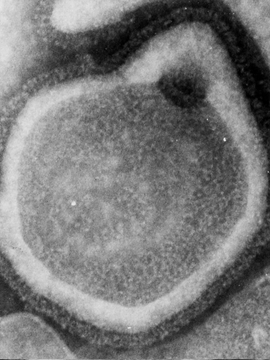 measles virus