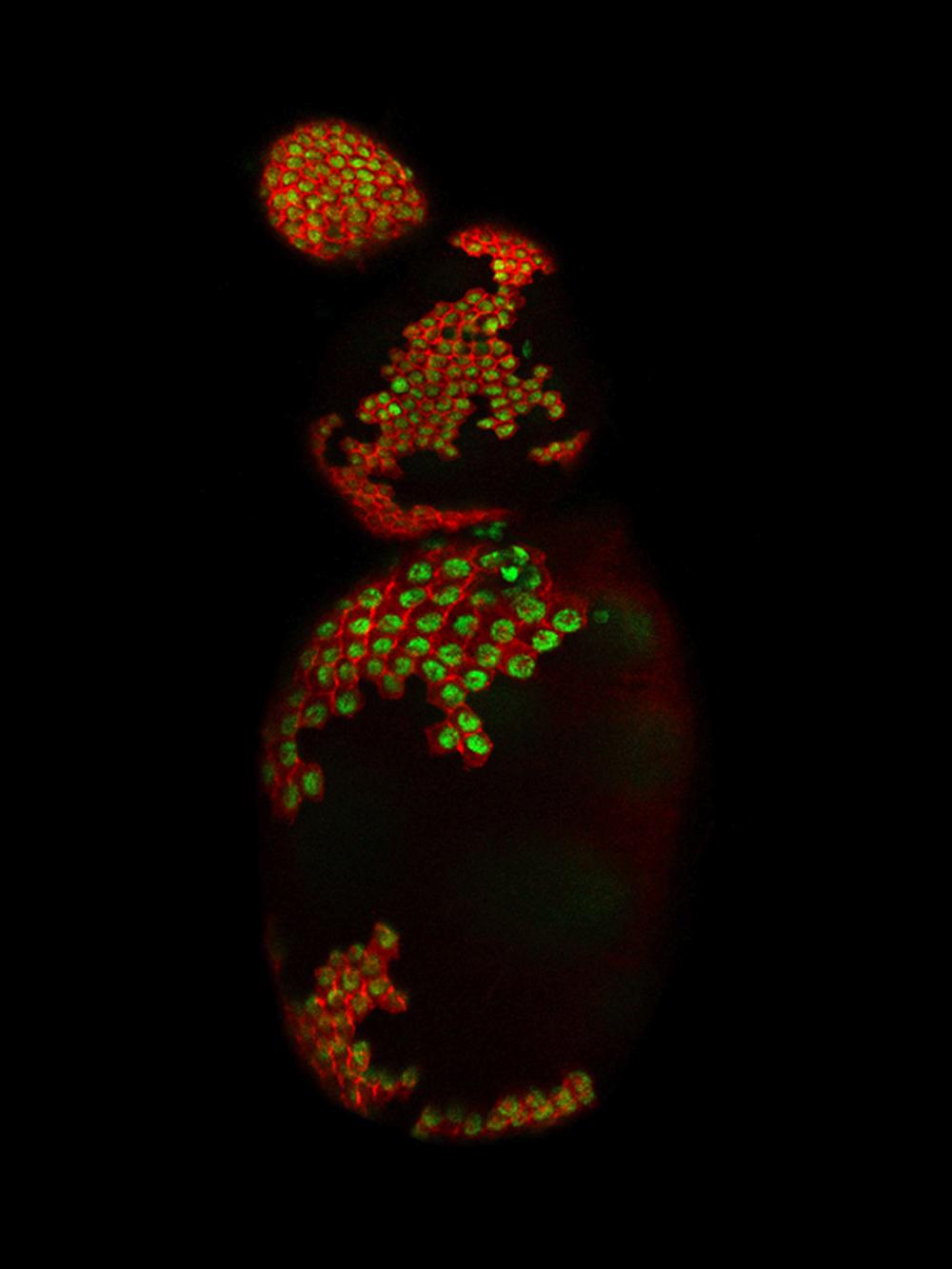 stained fruit fly eggs