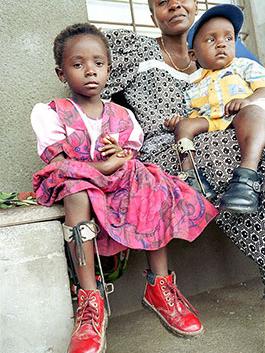Two children with polio with adult woman