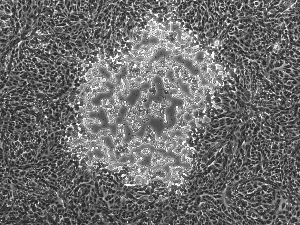 This image shows a focal point of infection by the herpes simplex virus type 1 